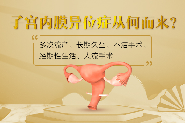 子宫内膜异位症的原因
